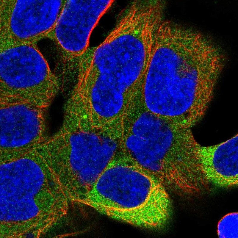 Atlas Antibodies Anti-PPP6R1 Antibody