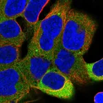 Atlas Antibodies Anti-PPP6R1 Antibody