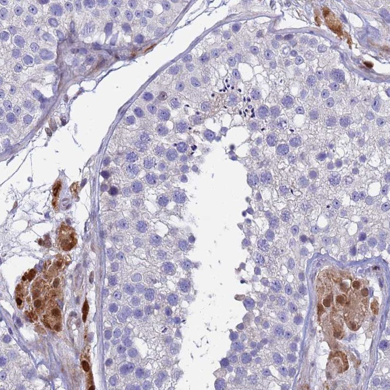 Atlas Antibodies Anti-PPP6R1 Antibody