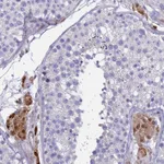 Atlas Antibodies Anti-PPP6R1 Antibody