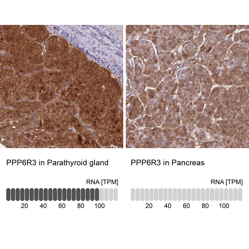 Atlas Antibodies Anti-PPP6R3 Antibody