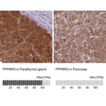 Atlas Antibodies Anti-PPP6R3 Antibody