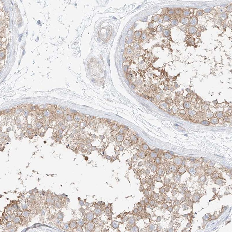 Atlas Antibodies Anti-PPP6R2 Antibody