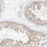 Atlas Antibodies Anti-PPP6R2 Antibody