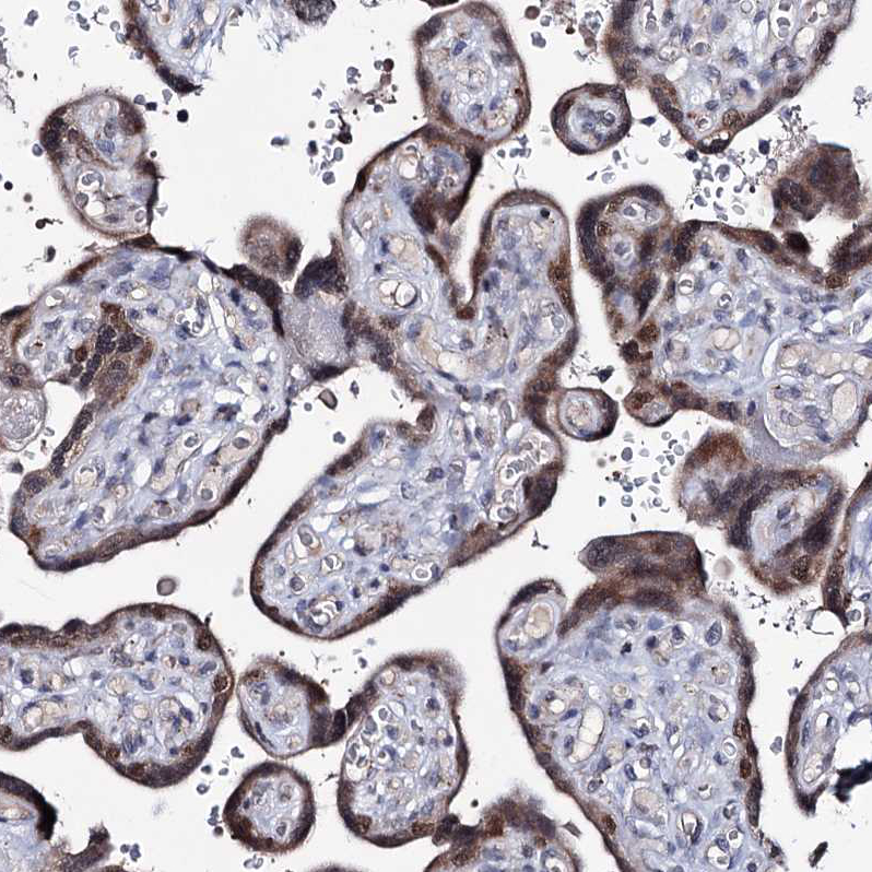 Atlas Antibodies Anti-PPRC1 Antibody