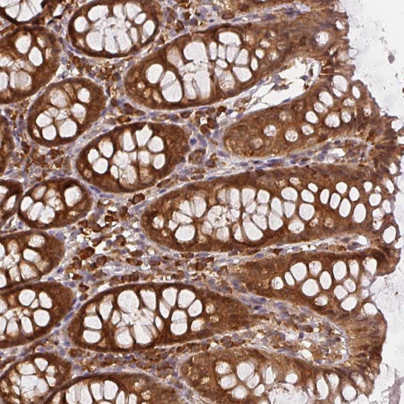Atlas Antibodies Anti-PPP6R3 Antibody