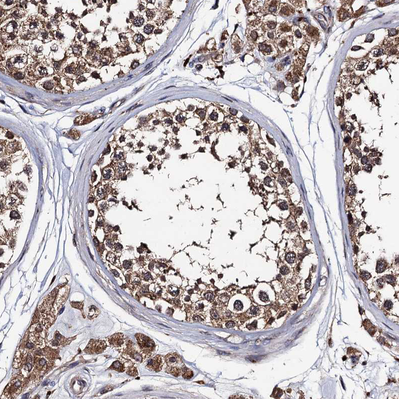 Atlas Antibodies Anti-PPTC7 Antibody