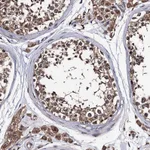 Atlas Antibodies Anti-PPTC7 Antibody