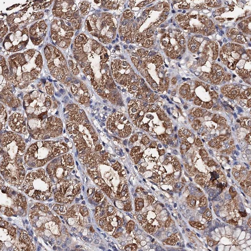 Atlas Antibodies Anti-PPTC7 Antibody