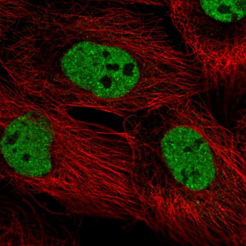 Atlas Antibodies Anti-PPRC1 Antibody