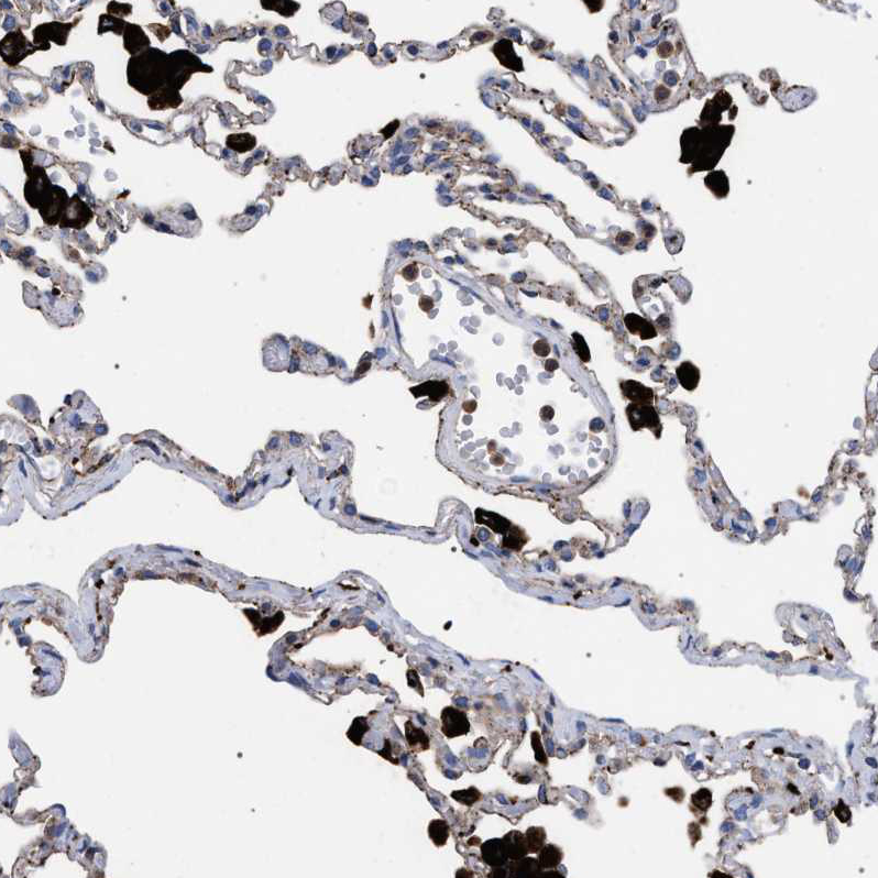 Atlas Antibodies Anti-PPT1 Antibody