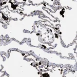 Atlas Antibodies Anti-PPT1 Antibody