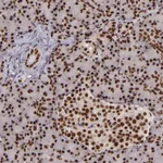 Atlas Antibodies Anti-PQBP1 Antibody