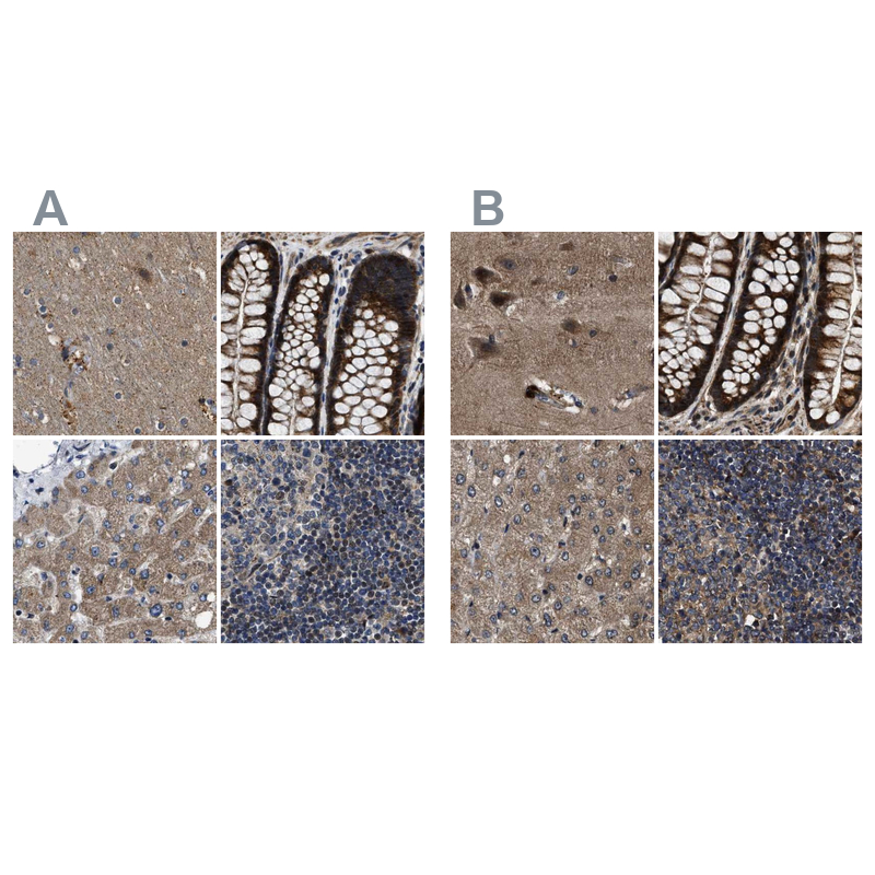 Atlas Antibodies Anti-PPWD1 Antibody