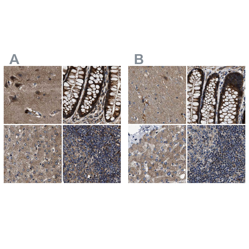 Atlas Antibodies Anti-PPWD1 Antibody