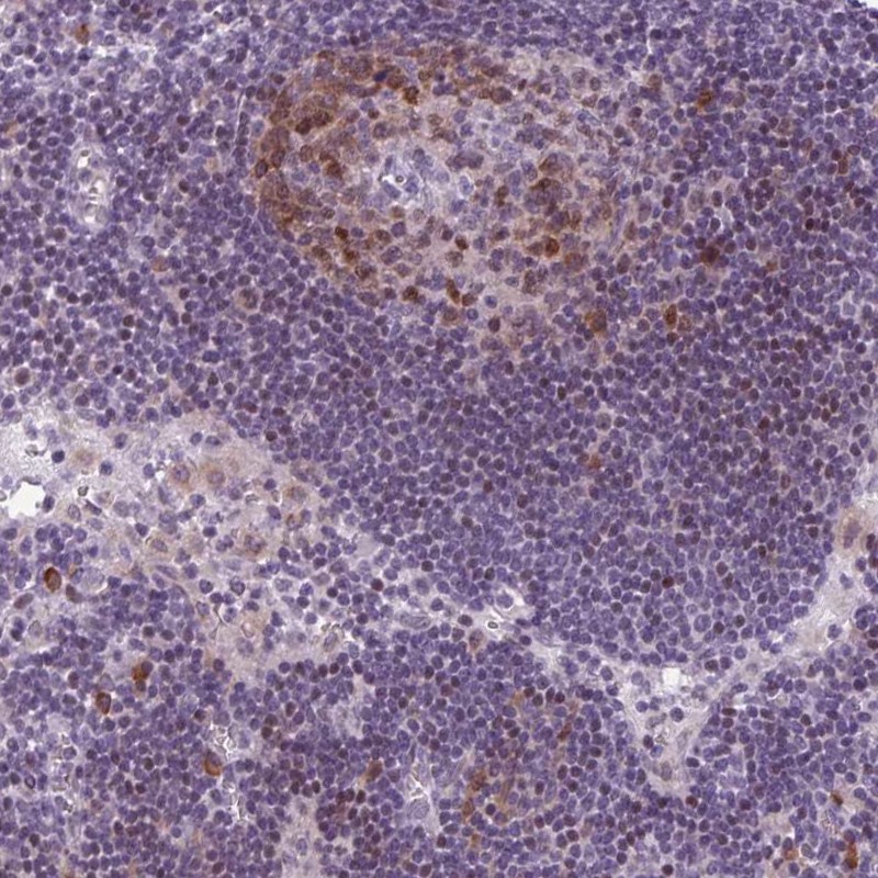 Atlas Antibodies Anti-PQLC1 Antibody