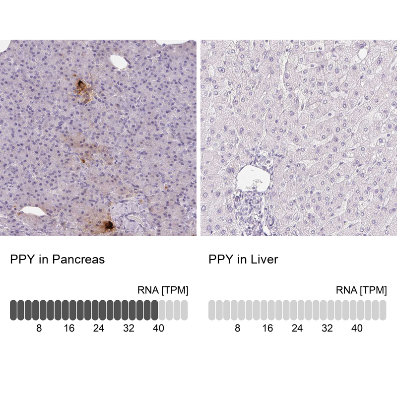 Atlas Antibodies Anti-PPY Antibody
