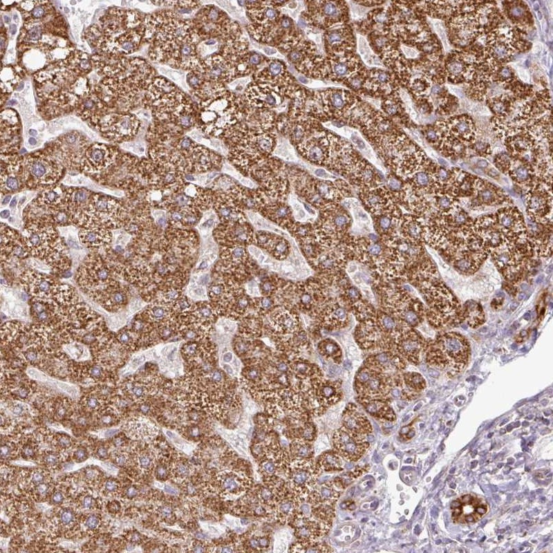 Atlas Antibodies Anti-PQLC2L Antibody