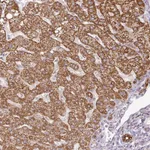 Atlas Antibodies Anti-PQLC2L Antibody