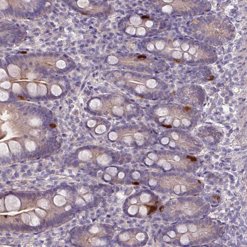 Atlas Antibodies Anti-PRADC1 Antibody