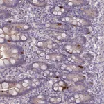 Atlas Antibodies Anti-PRADC1 Antibody