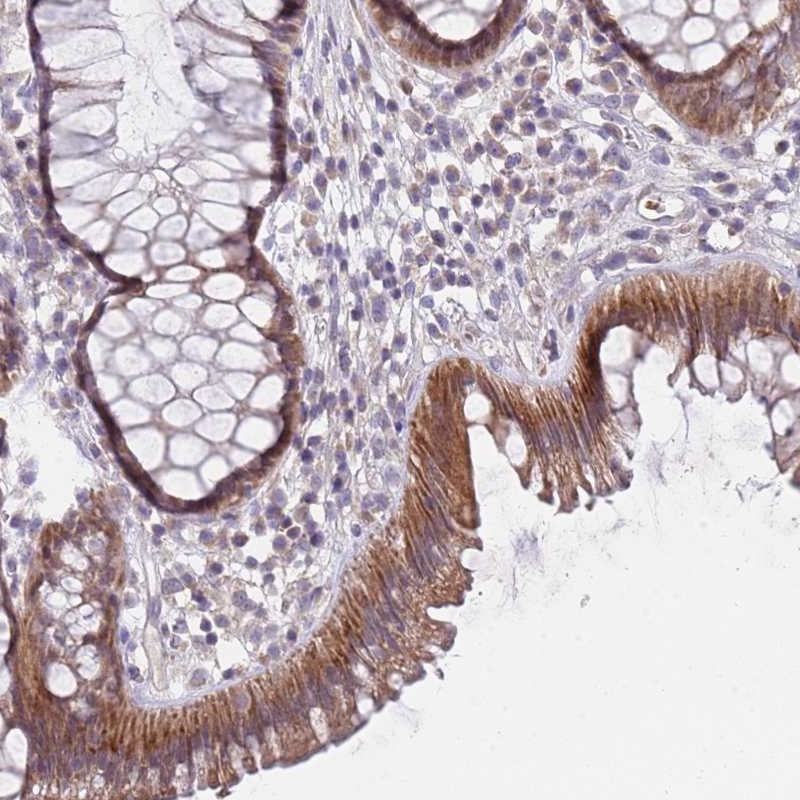 Atlas Antibodies Anti-PRAC1 Antibody