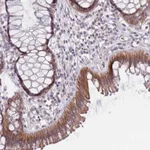 Atlas Antibodies Anti-PRAC1 Antibody