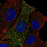 Atlas Antibodies Anti-PQLC3 Antibody