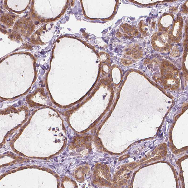 Atlas Antibodies Anti-PRAG1 Antibody