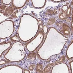 Atlas Antibodies Anti-PRAG1 Antibody