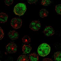 Atlas Antibodies Anti-PRAME Antibody