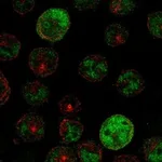 Atlas Antibodies Anti-PRAME Antibody