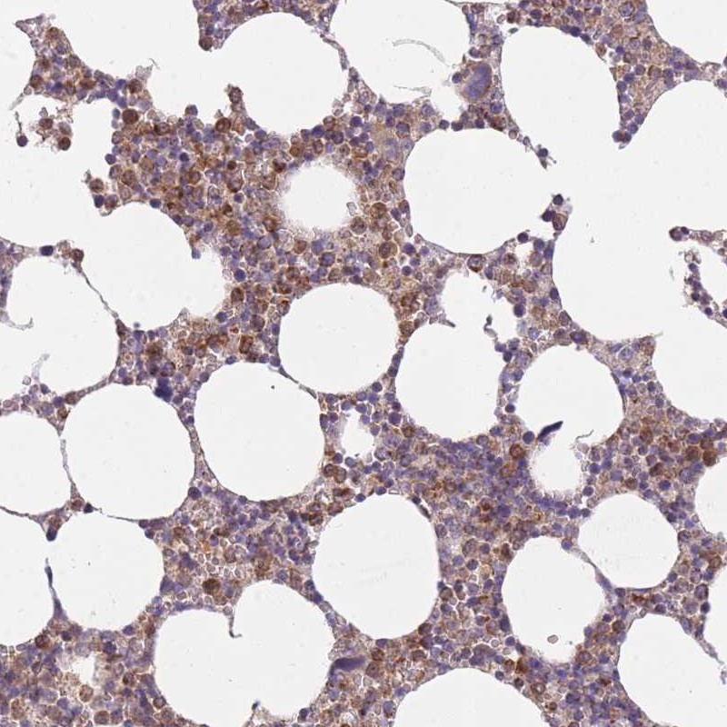 Atlas Antibodies Anti-PRAM1 Antibody