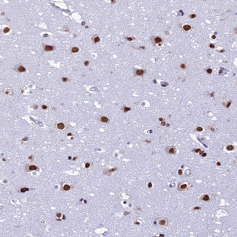 Atlas Antibodies Anti-PRAMEF12 Antibody