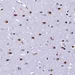 Atlas Antibodies Anti-PRAMEF12 Antibody