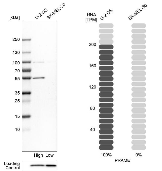 Atlas Antibodies Anti-PRAME Antibody