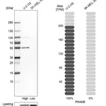Atlas Antibodies Anti-PRAME Antibody