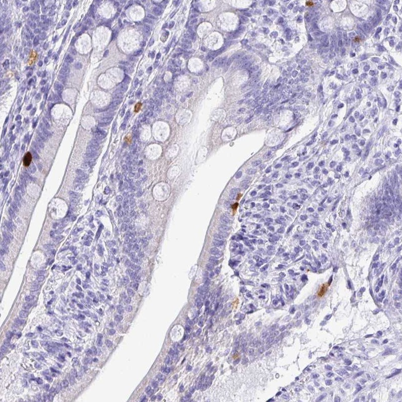 Atlas Antibodies Anti-PRAMEF19 Antibody