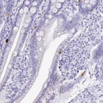 Atlas Antibodies Anti-PRAMEF19 Antibody