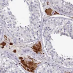 Atlas Antibodies Anti-PRAMEF7 Antibody