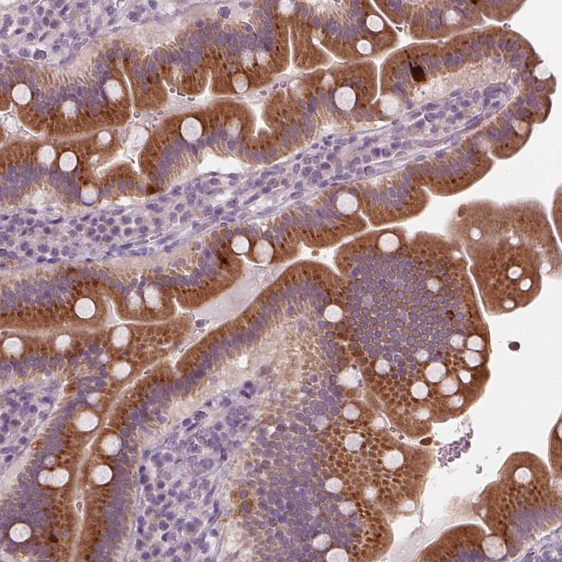 Atlas Antibodies Anti-PRAP1 Antibody