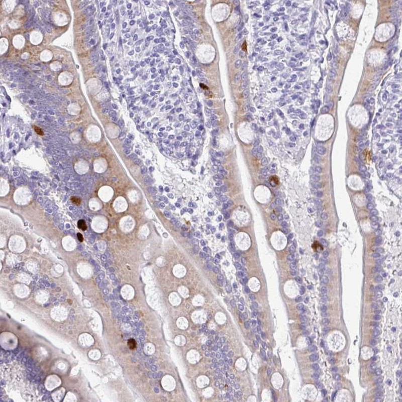 Atlas Antibodies Anti-PRAP1 Antibody