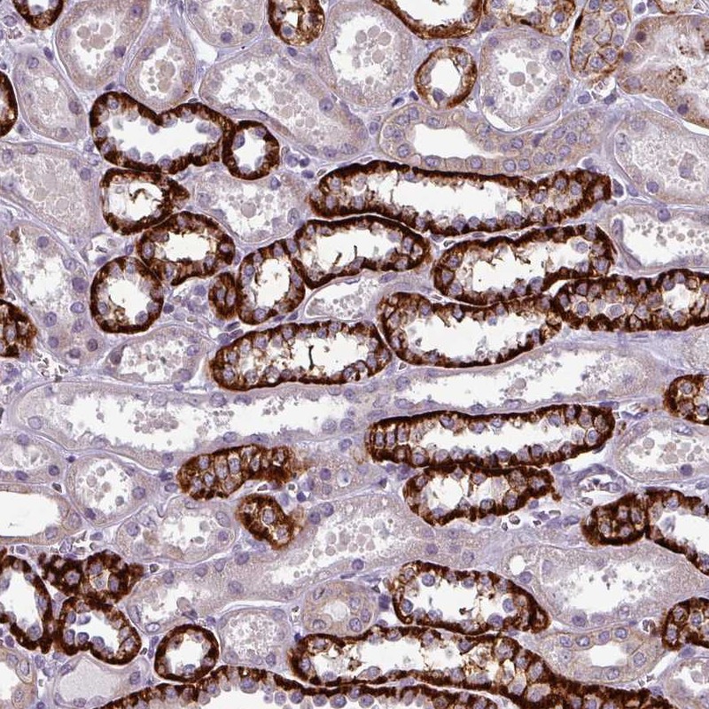 Atlas Antibodies Anti-PRAMEF7 Antibody