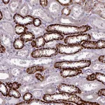 Atlas Antibodies Anti-PRAMEF7 Antibody
