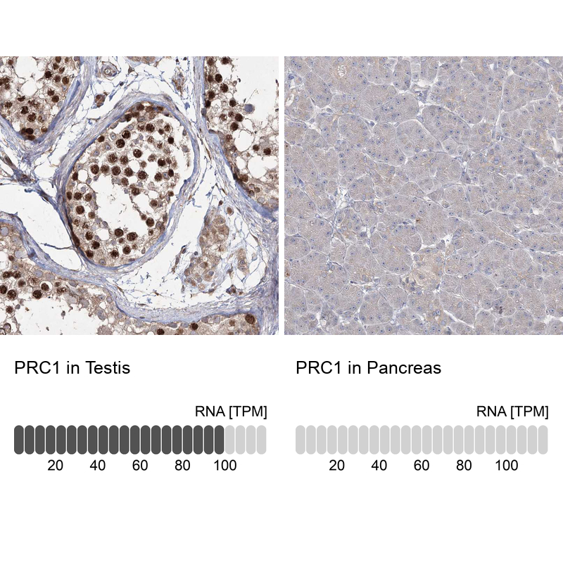 Atlas Antibodies Anti-PRC1 Antibody