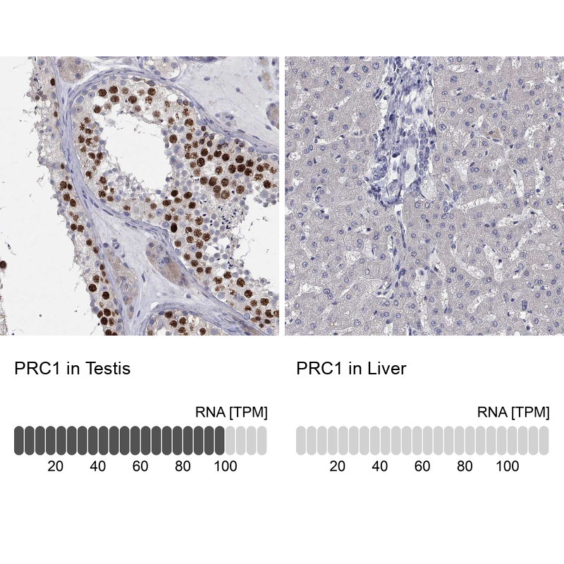 Atlas Antibodies Anti-PRC1 Antibody