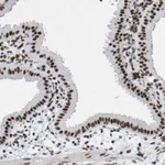 Atlas Antibodies Anti-PRCC Antibody