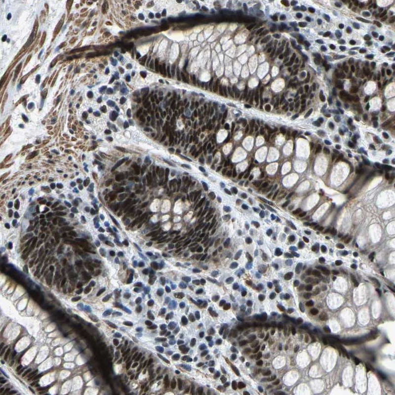 Atlas Antibodies Anti-PRCC Antibody