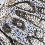Atlas Antibodies Anti-PRCC Antibody