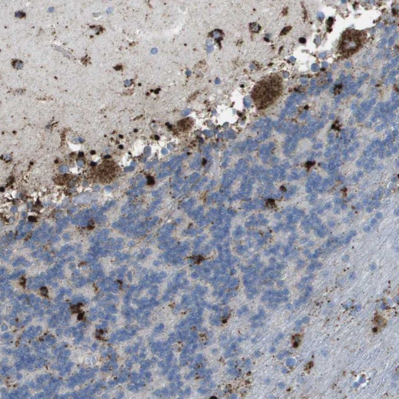 Atlas Antibodies Anti-PRCP Antibody